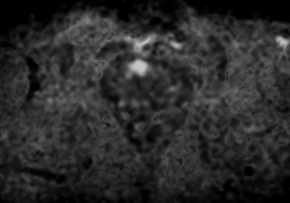 Axial Diffusion (b1500)