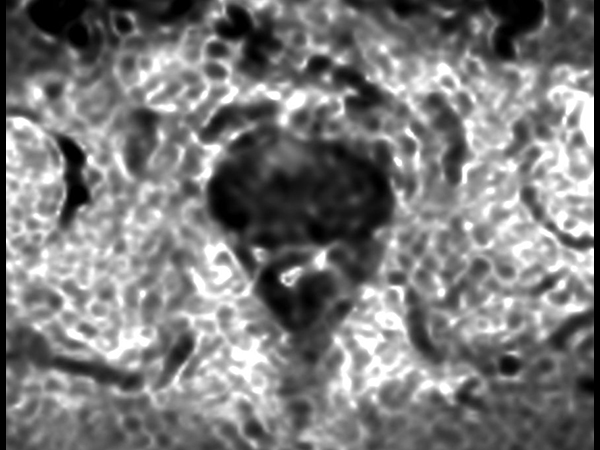 Axial Diffusion (eADC)