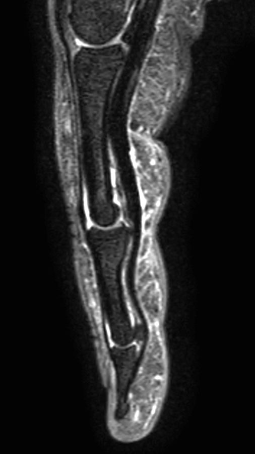 Sagittal T2w TSE mDIXON XD