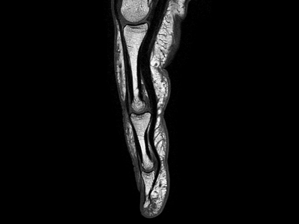 Sagittal T1w TSE