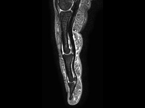 Sagittal T2w TSE mDIXON XD