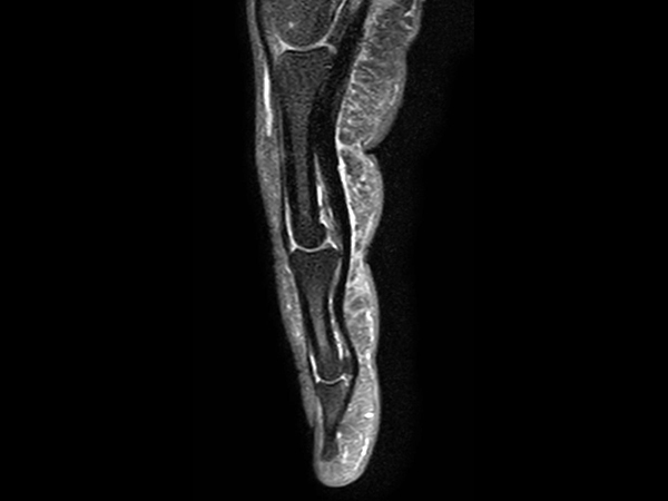 Sagittal PDw FatSat