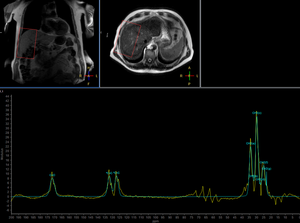 13C Phase Acquired<b>No Decoupling</b>