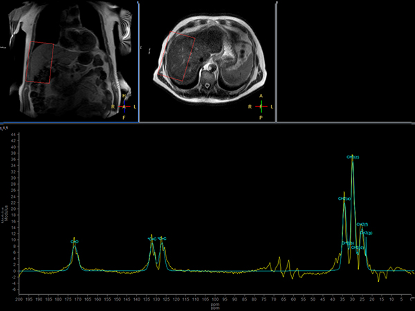 13C Phase Acquired<b>No Decoupling</b>