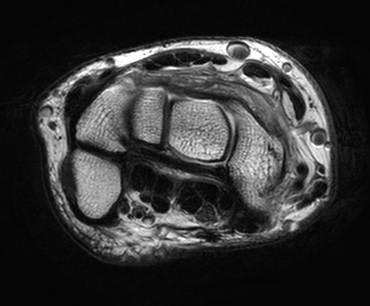 Axial T2w TSE<b>SmartSpeed</b>