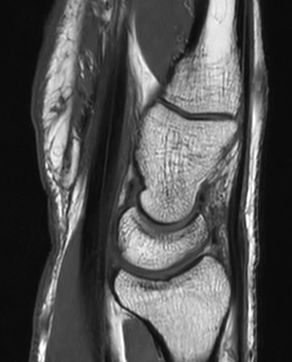 Sagittal T1w TSE<b>SmartSpeed</b>