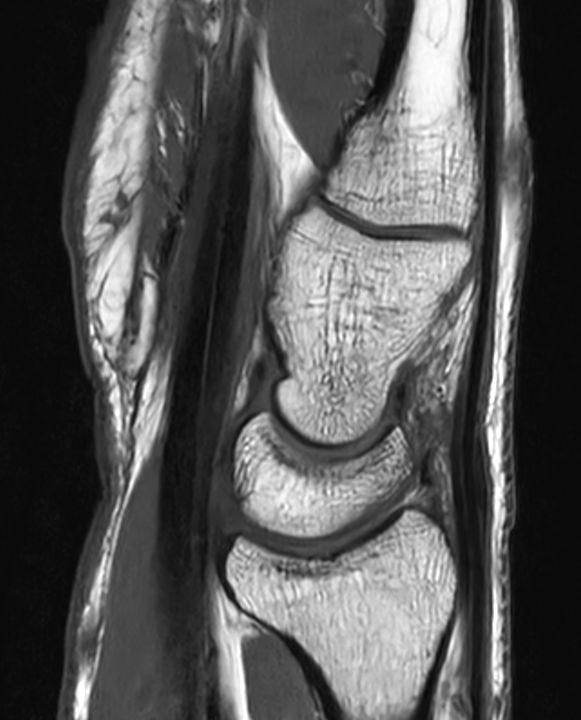 Sagittal T1w TSE<b>SmartSpeed Resolution</b>