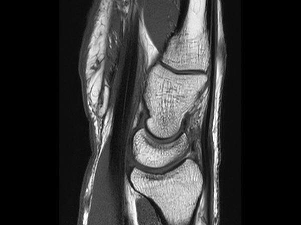 Sagittal T1w TSE