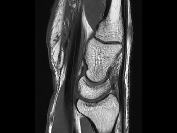 Sagittal T1w TSE<b>SmartSpeed</b>