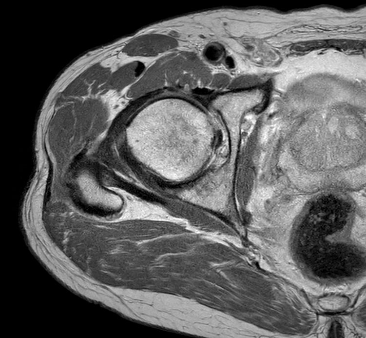 Axial PDw TSE<b>SmartSpeed High Resolution</b>