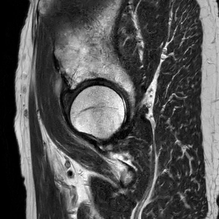 Sagittal T2w TSE<b>SmartSpeed Resolution</b>