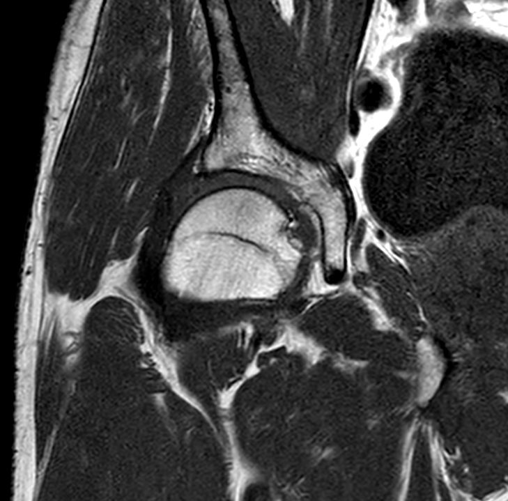 Coronal T1w TSE<b>SmartSpeed Resolution</b>