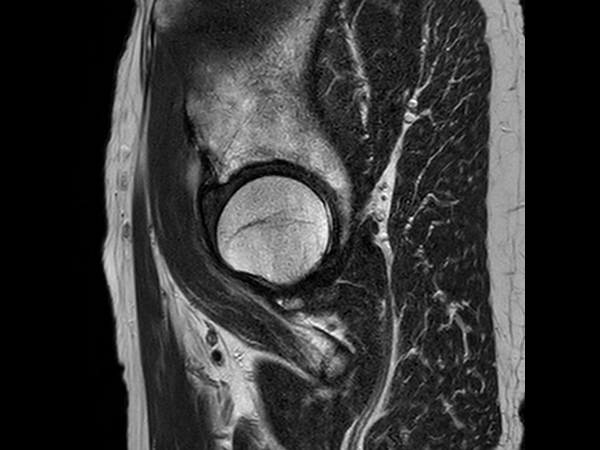 Sagittal T2w TSE 