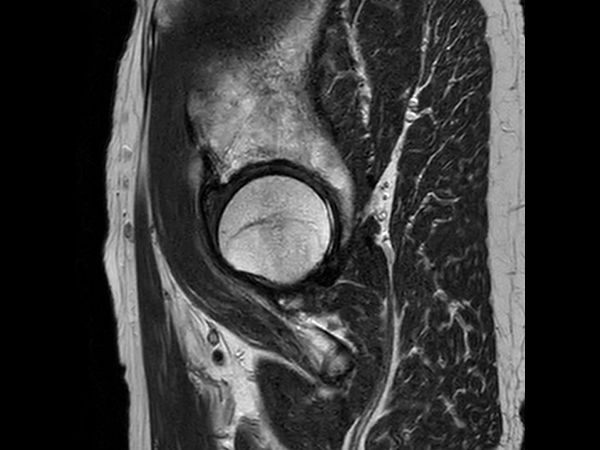 Sagittal T2w TSE<b>SmartSpeed</b>