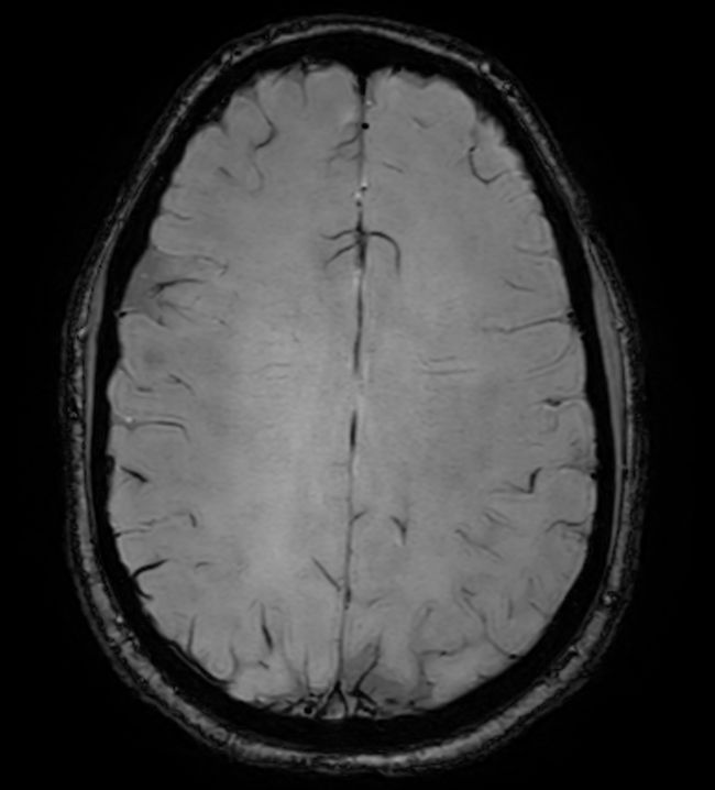 Axial SWIp (Modulus)