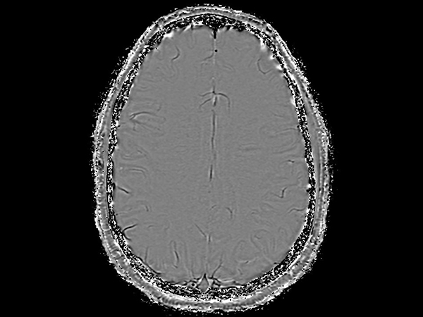 Axial SWIp (Phase)