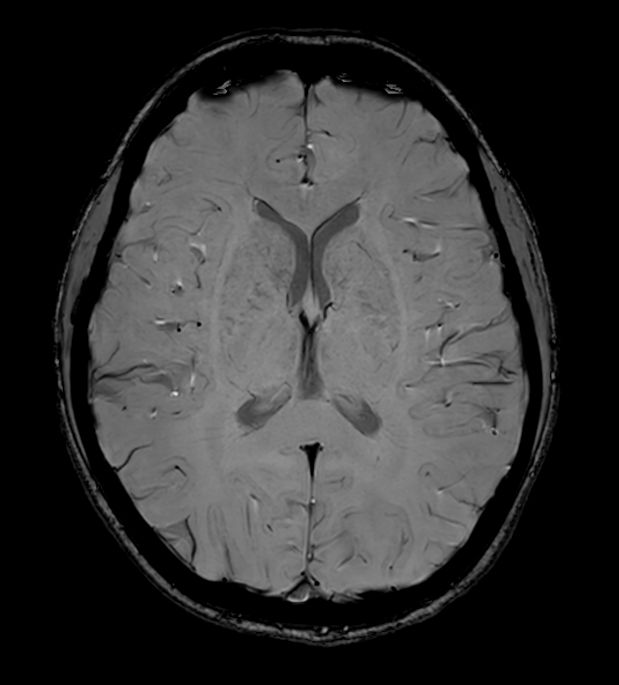 Axial SWIp (Modulus)