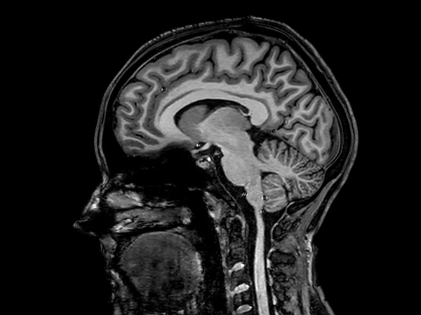 Sagittal 3D T1w TFE