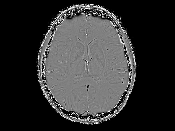 Axial SWIp (Phase)