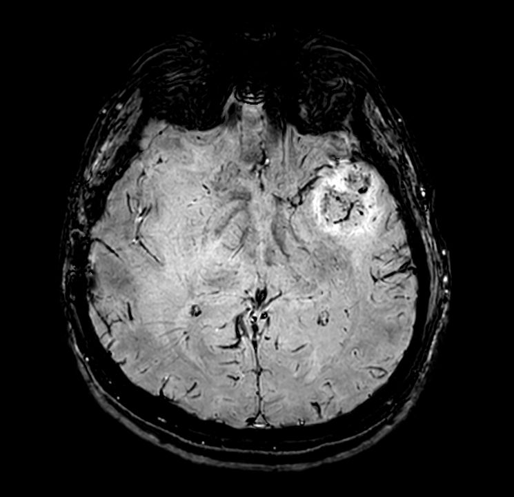 Axial SWIp (Modulus)