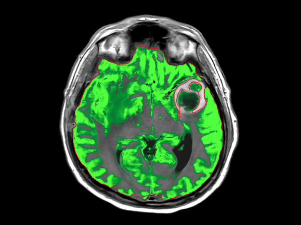 Axial SyntAc (Grey Matter)