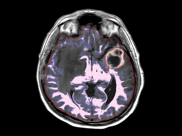 Axial SyntAc (White Matter)