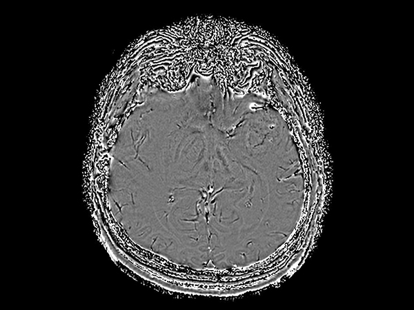 Axial SWIp (Phase)