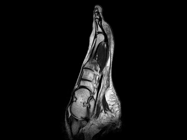 Sagittal T2w TSE