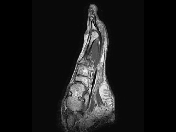 Sagittal T1w TSE