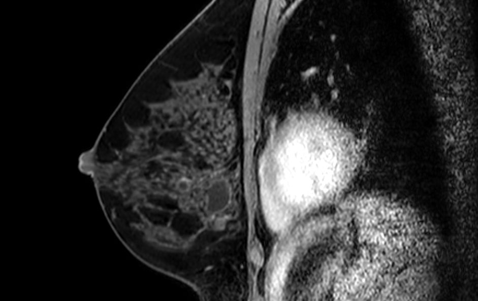 3D VANE XD (sagital reformat)