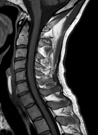 Sagittal T1w TSE