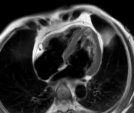 Black Blood 4 Chamber