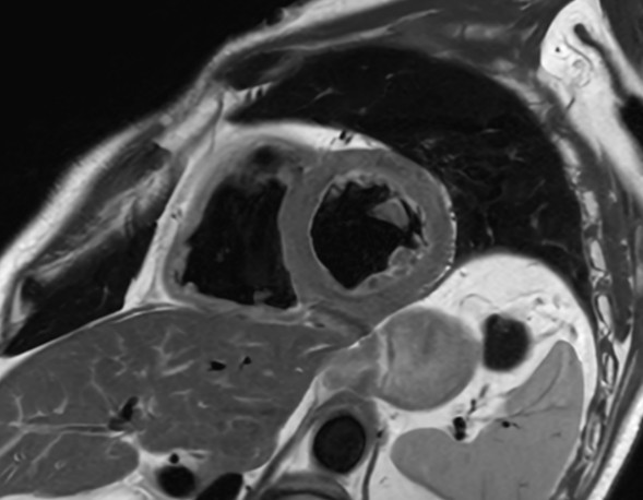 Black Blood Short Axis (High Res)