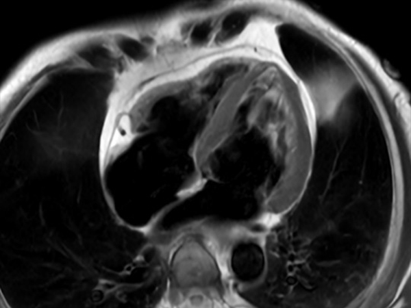 Black Blood 4 Chamber