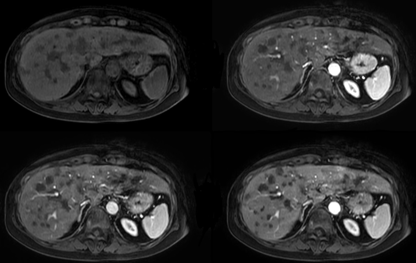 Axial Dynamic eTHRIVE 