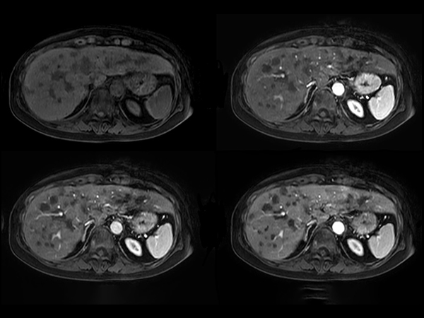 Axial Dynamic eTHRIVE 