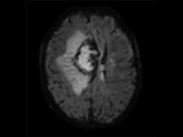 Axial T2* Perfusion