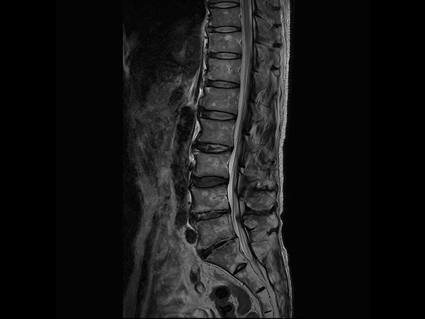 Sagittal T2w TSE