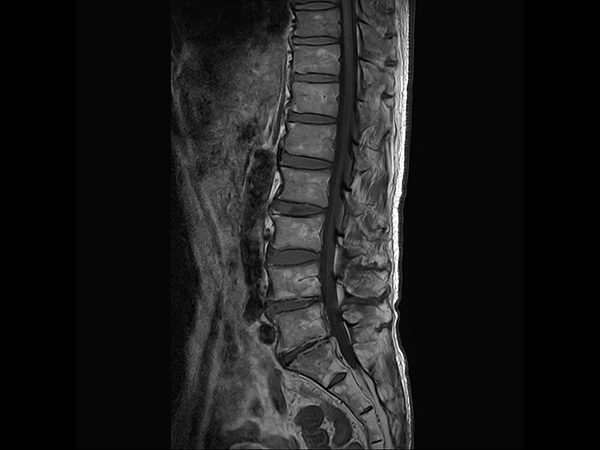 Sagittal T1w TSE