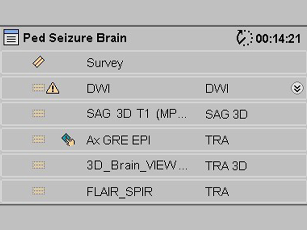 ExamCard: Pediatric Seizure Brain