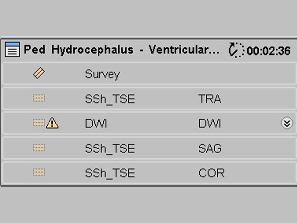 ExamCard: Pediatric Hydrocephalus