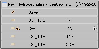 ExamCard: Pediatric Hydrocephalus