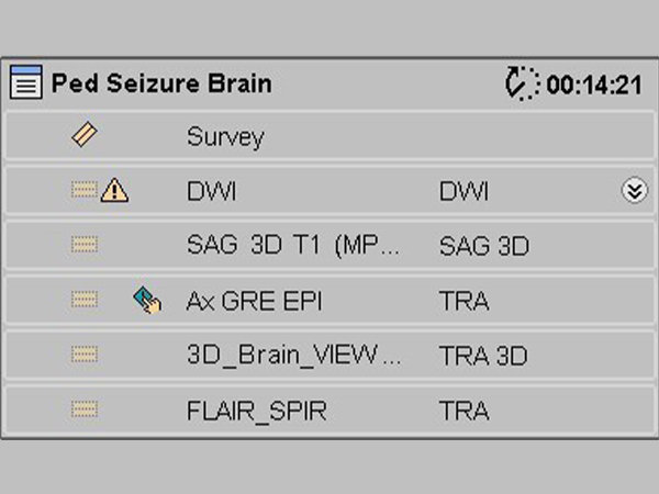 ExamCard: Pediatric Seizure Brain