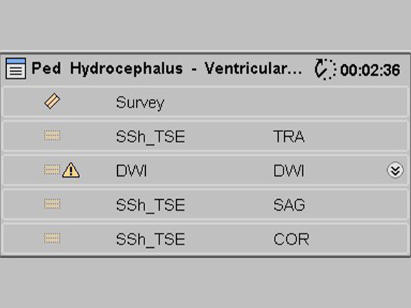 ExamCard: Pediatric Hydrocephalus