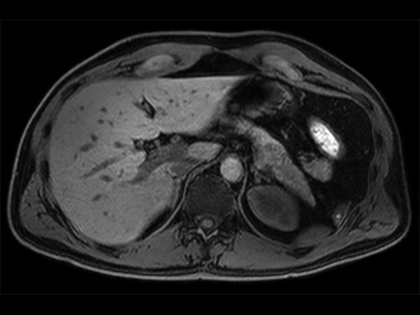 Axial dynamic mDIXON