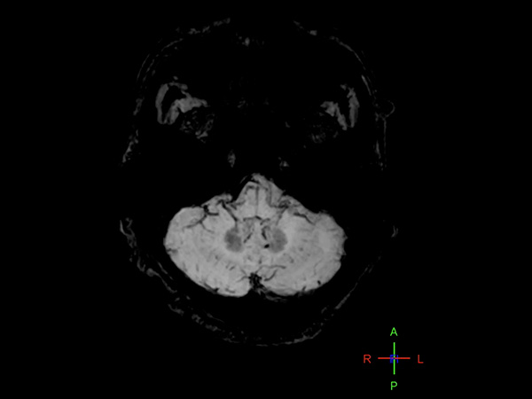 Axial VenBOLD