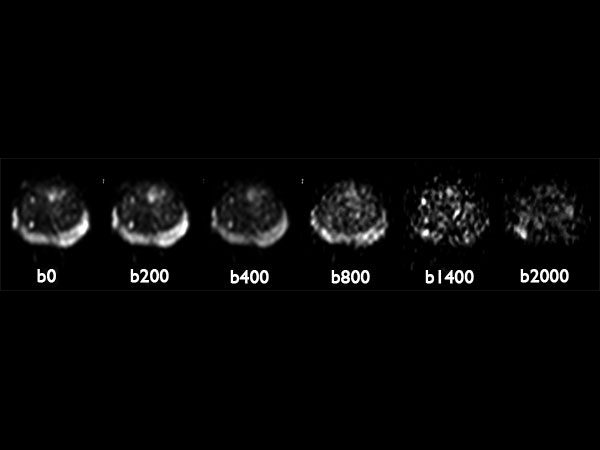 Axial Diffusion