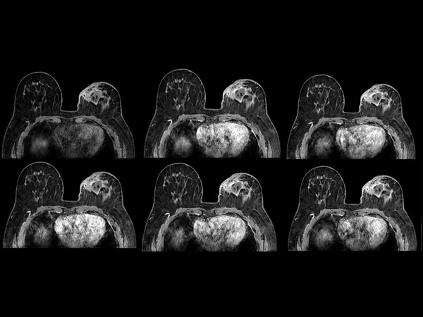 Dynamic axial eTHRIVE