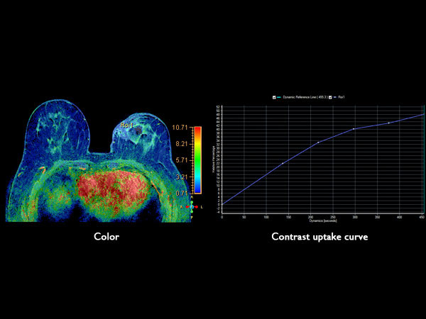 Dynamic axial eTHRIVE