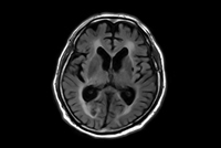 Brain imaging with MultiVane XD